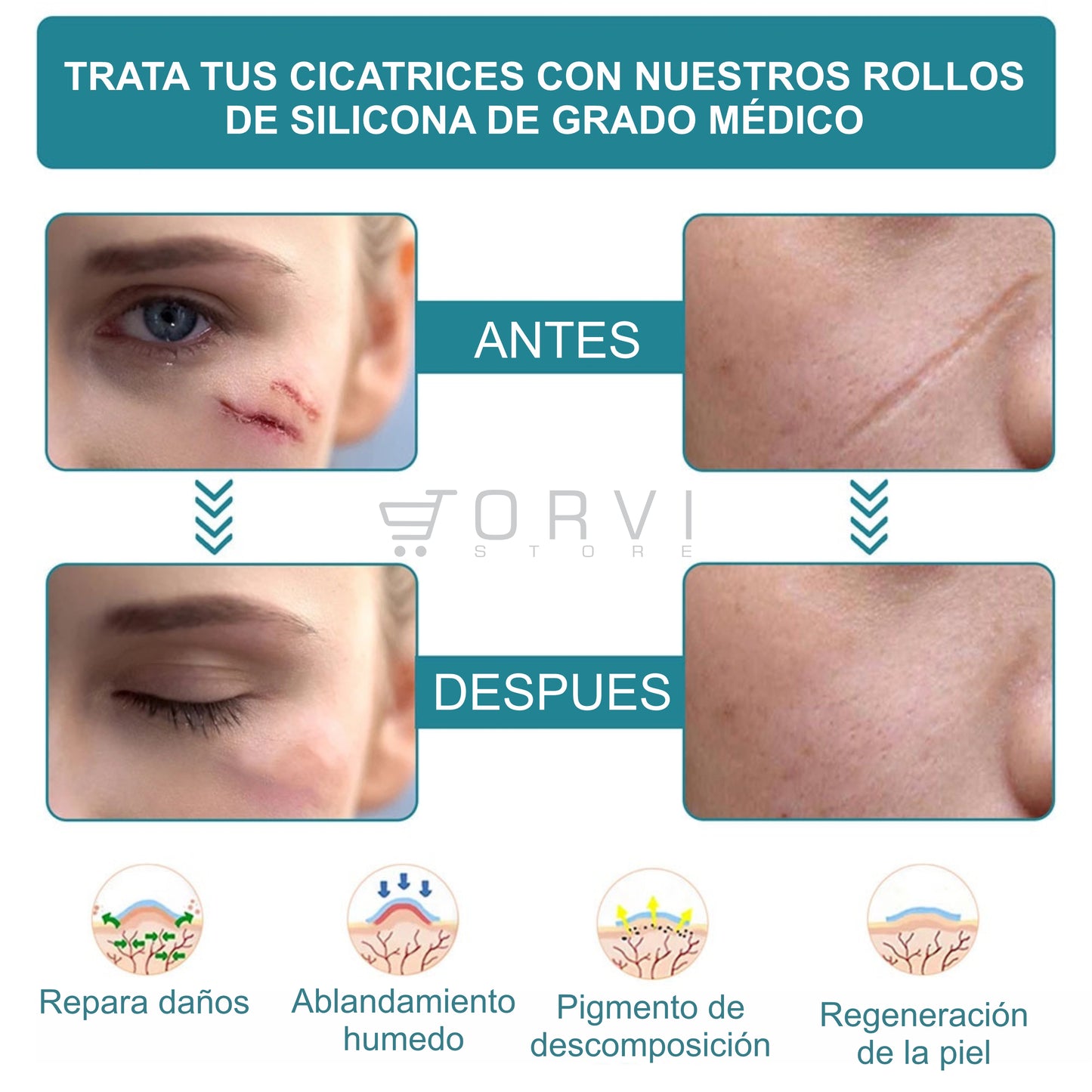 Cinta Parche Silicona Eliminación De Cicatrices Reutilizable