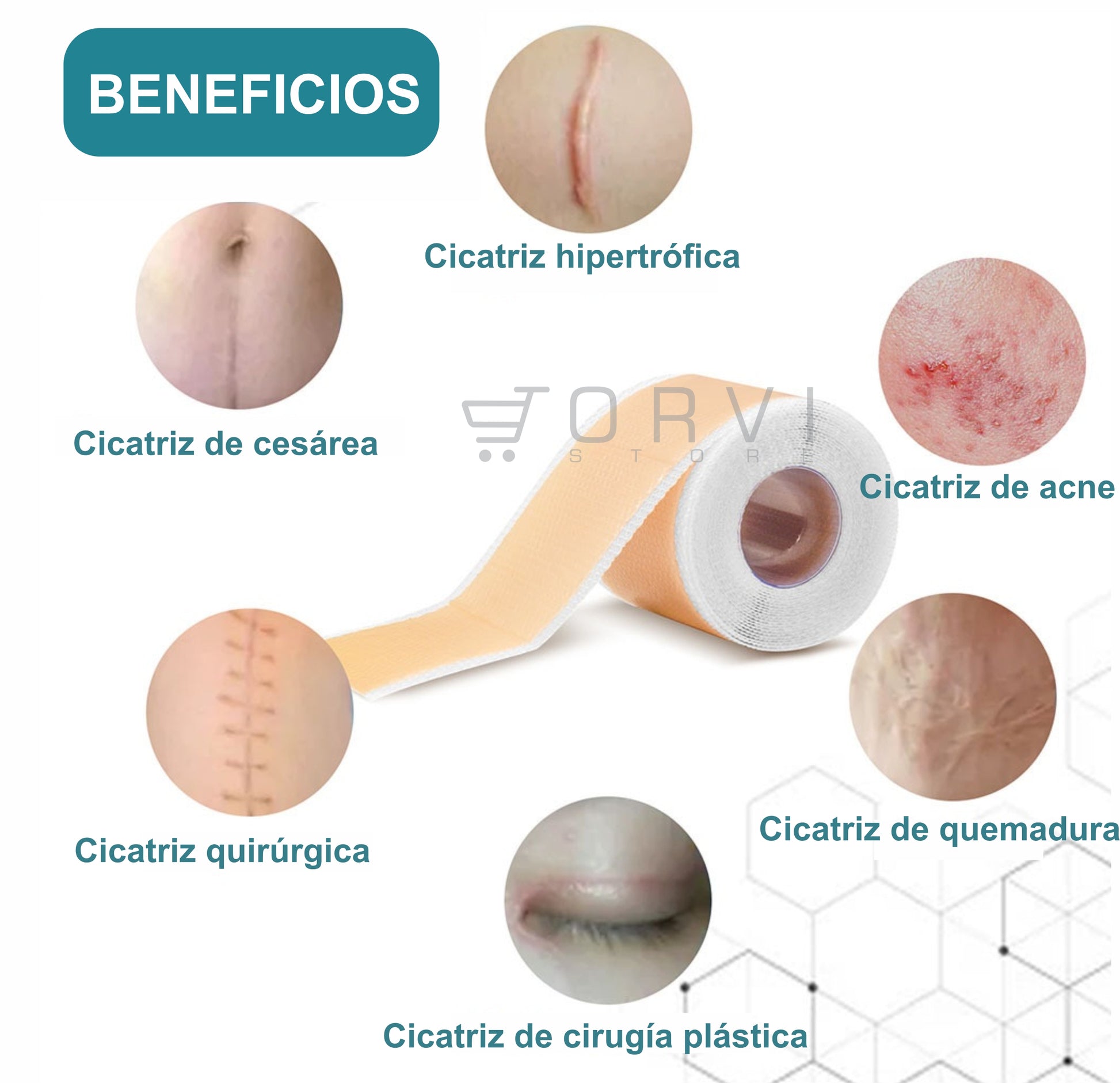 Cinta Parche Silicona Eliminación De Cicatrices Reutilizable