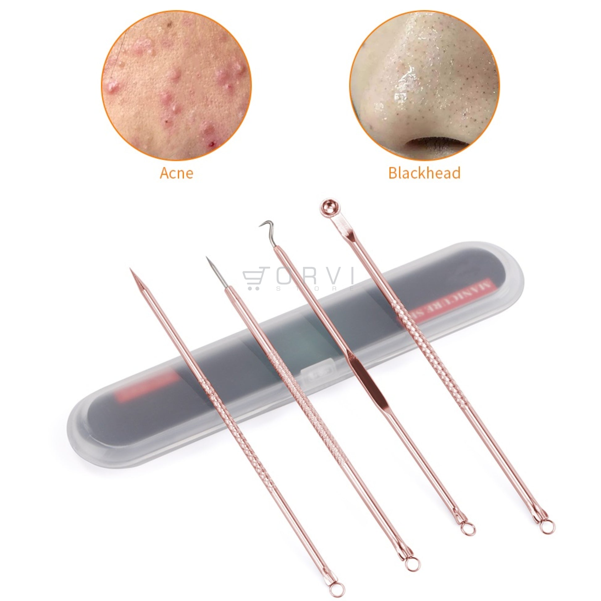 Kit Extractor Removedor Espinillas Acné Puntos Negros 4 Unds