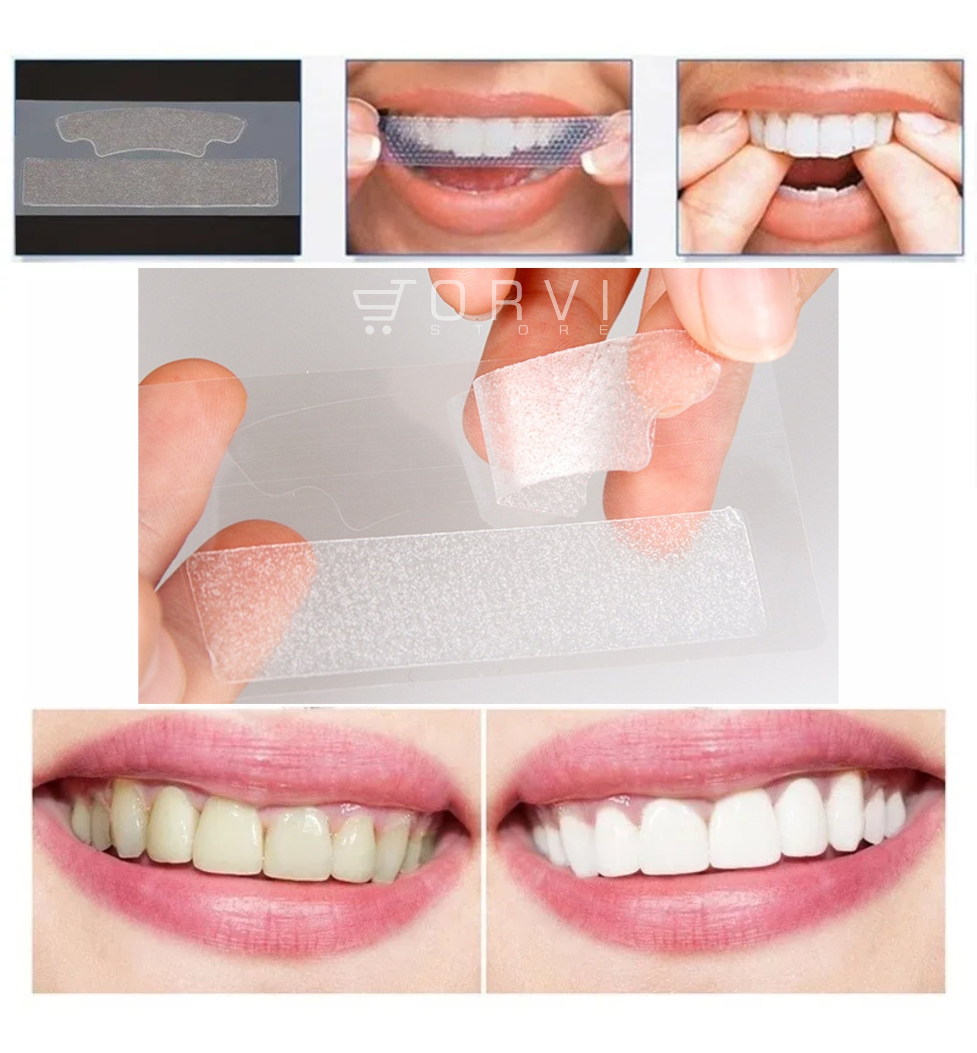 Blanqueador Dental 3d White Bandas Tiras Blanqueamiento Dientes x7 Sobres