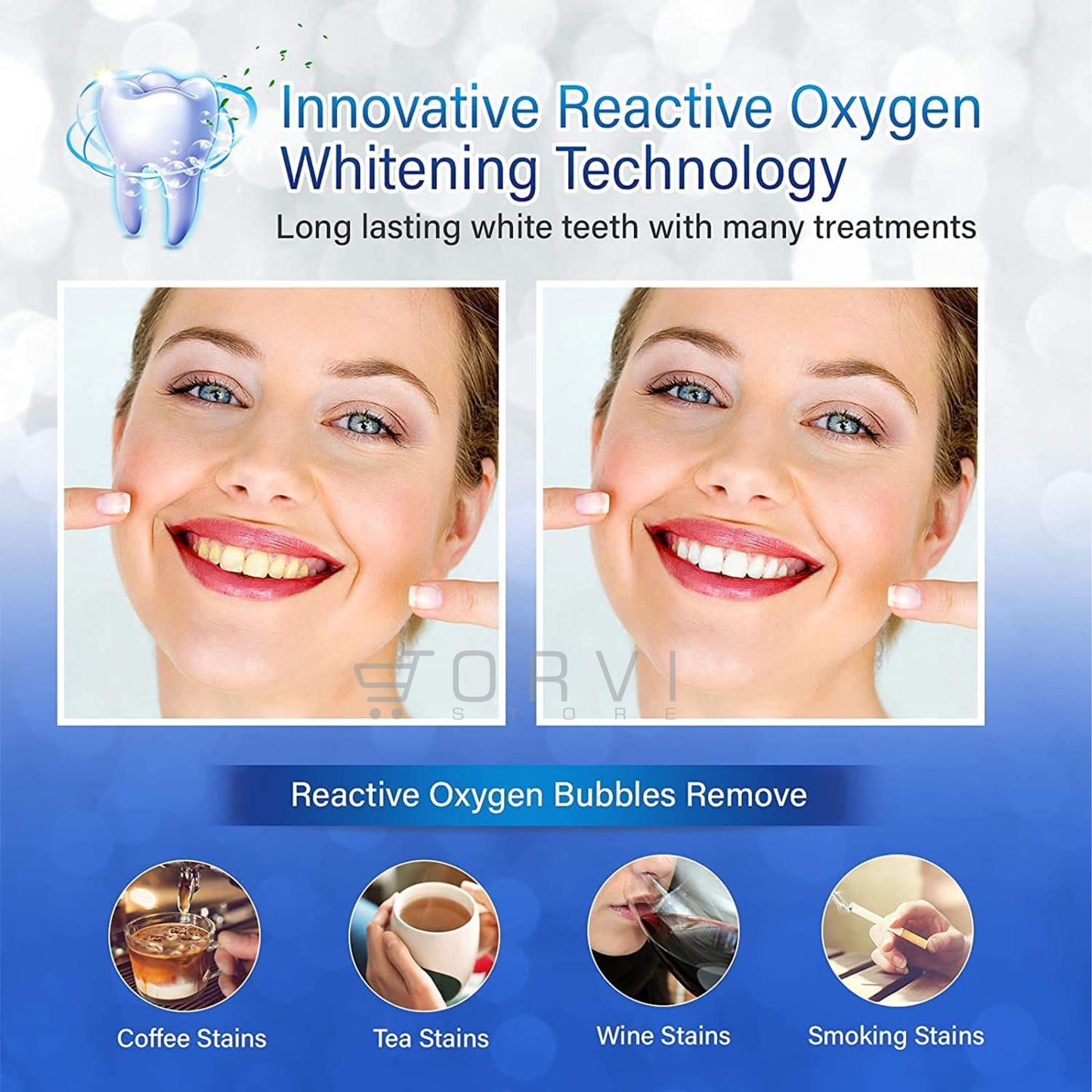 Blanqueador Dental 3d White Bandas Tiras Blanqueamiento Dientes x7 Sobres