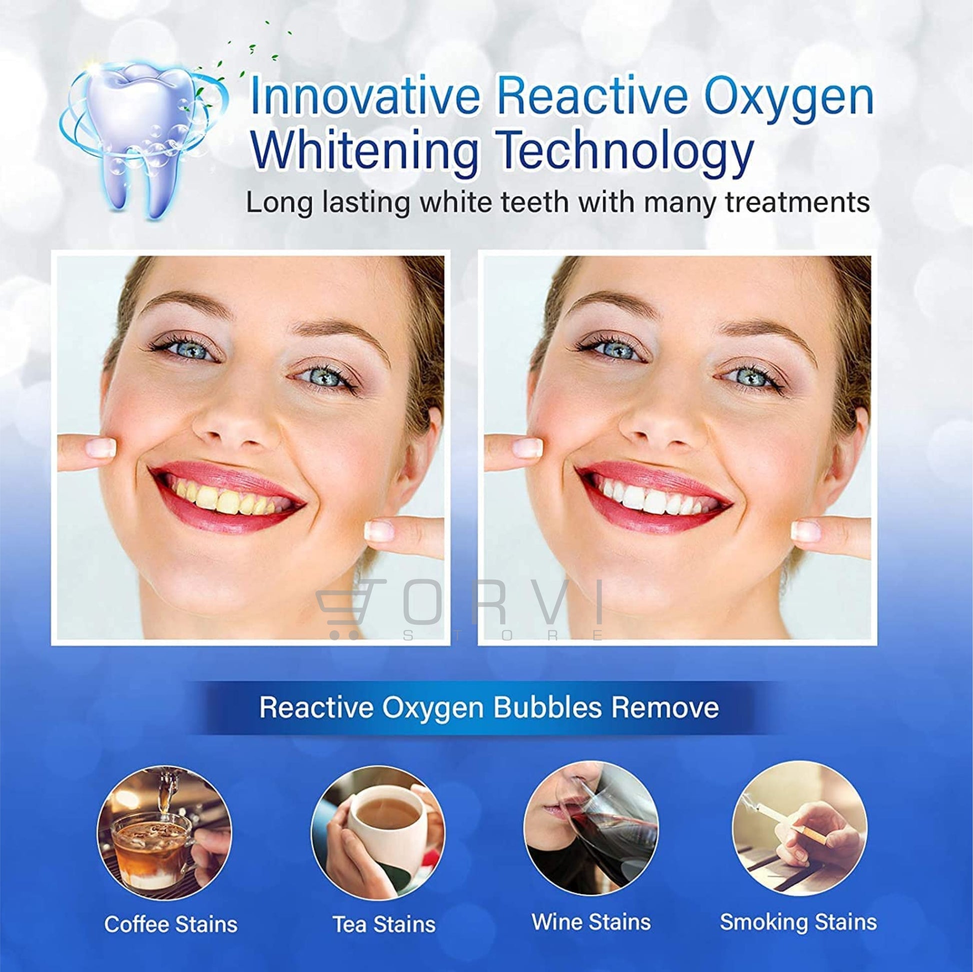 Blanqueador Dental 3d White Bandas Tiras Blanqueamiento Dientes x7 Sobres